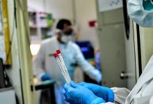 Photo of مستجدات فيروس كورونا بالمغرب خلال 24 ساعة المنصرمة