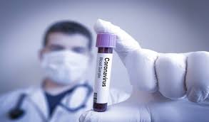 Photo of حرب كورونا: استراليا تدخل على خط التسابق حول اكتشافات دواء فيروس كورونا